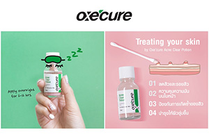 แนะนำ Oxe’cure Acne Clear Potion โพชั่นเคลียร์สิว สูตรใหม่จากประเทศญี่ปุ่น สิวยุบเร็วภายใน 6 ชั่วโมง
